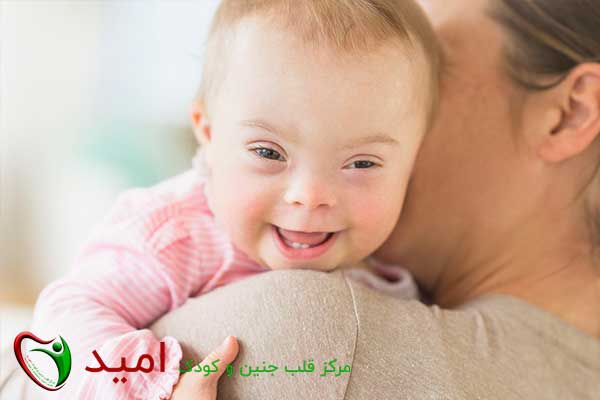 شایعترین مشکلات قلبی مادرزادی در نوزادان سندرم داون