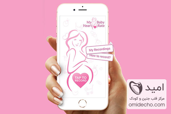 استفاده از اپلیکیشن‌ها برای شنیدن صدای قلب جنین‌